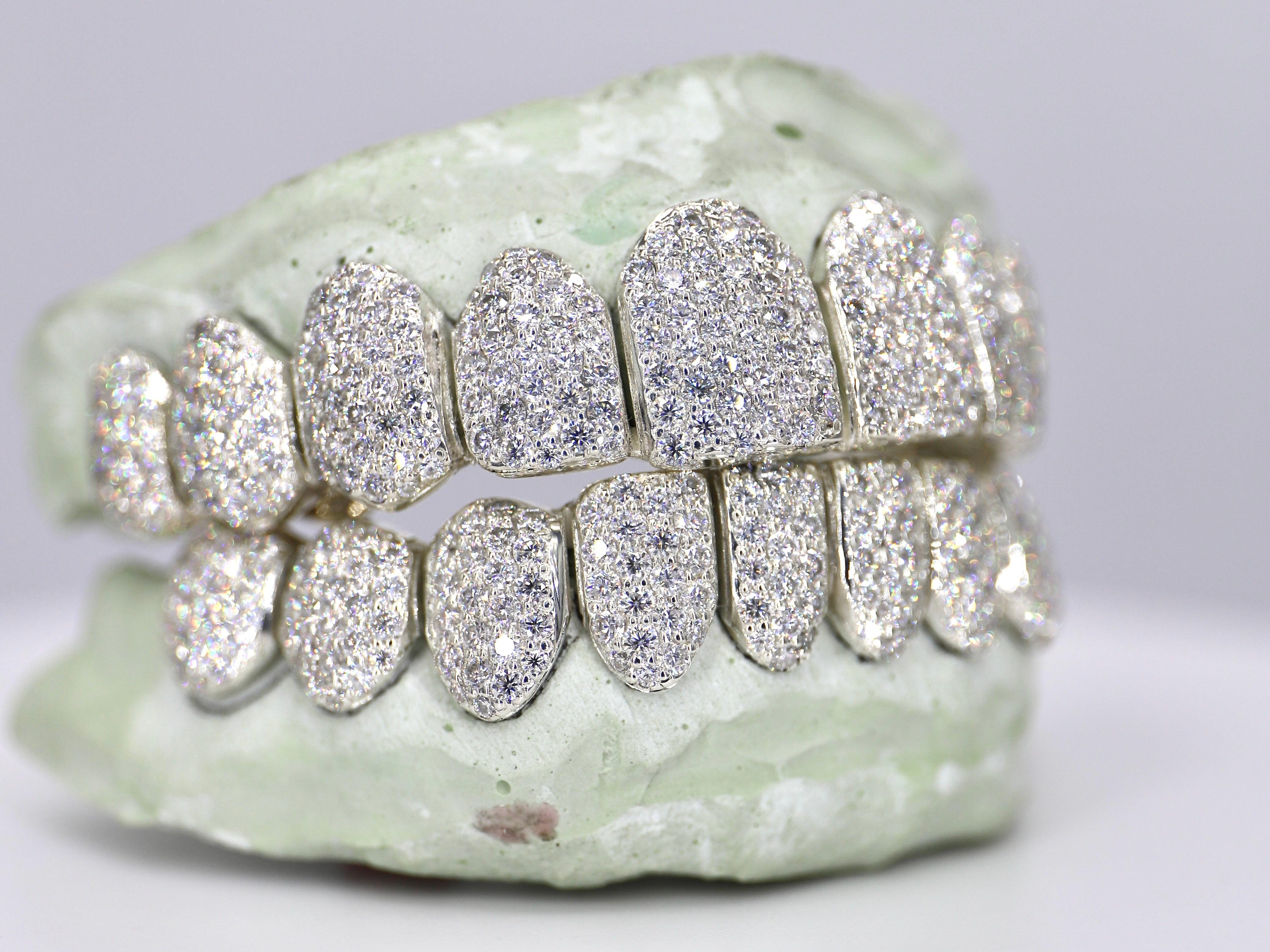 10 on 10 VVS+ Moissanite Grillz