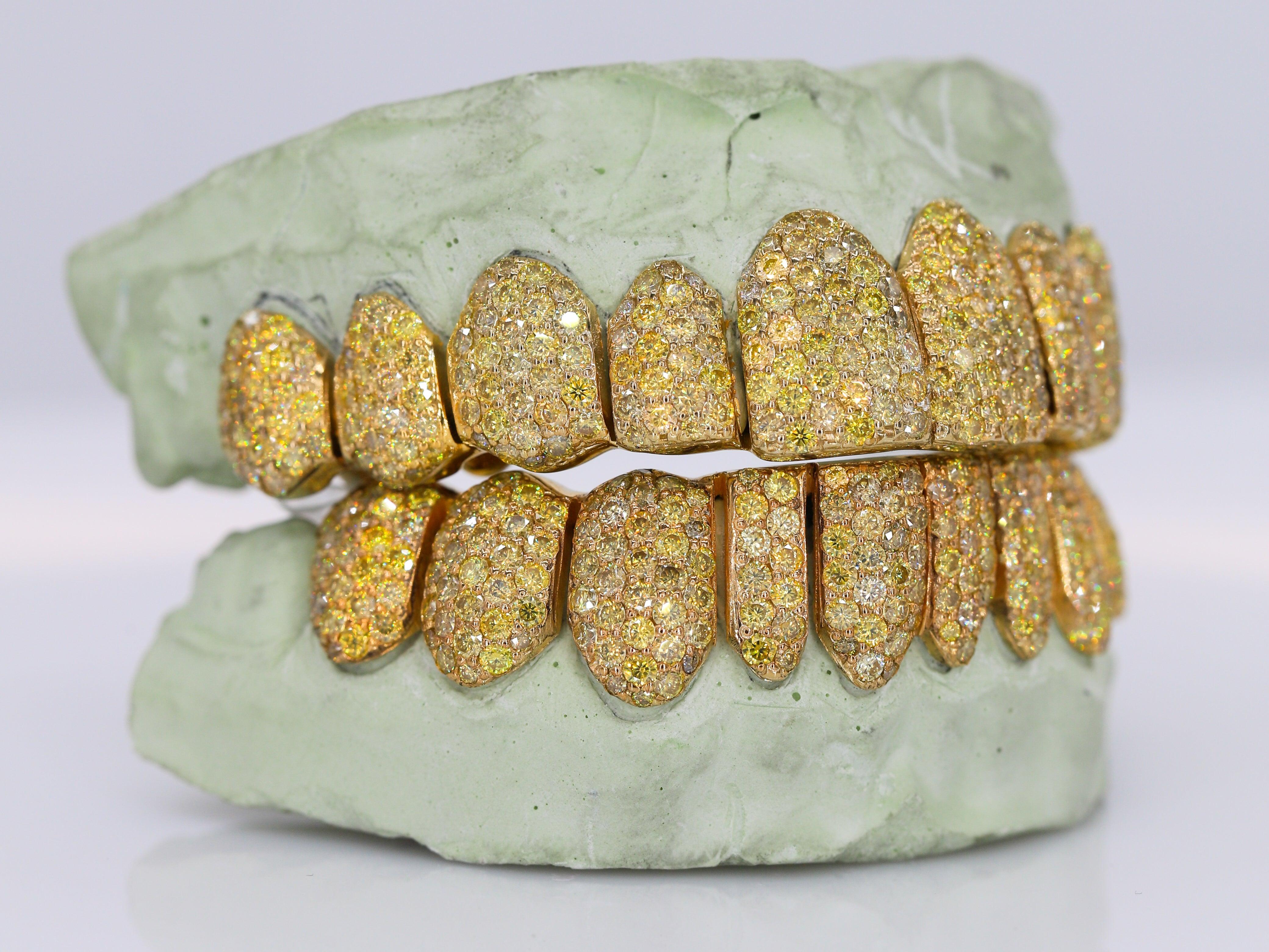 Canary Yellow VVS Moissanite Grillz