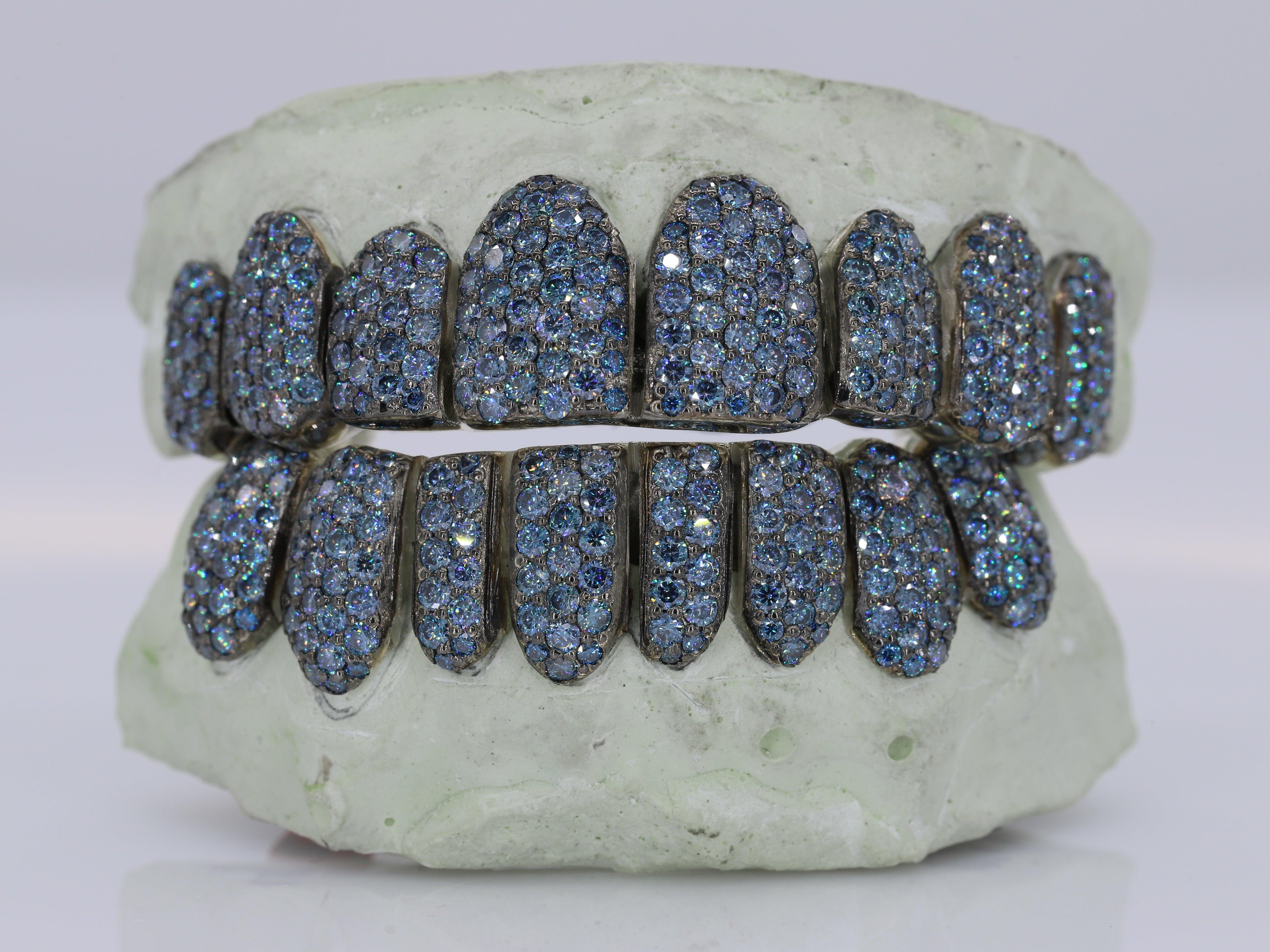 Ice Blue VVS Moissanite Grillz