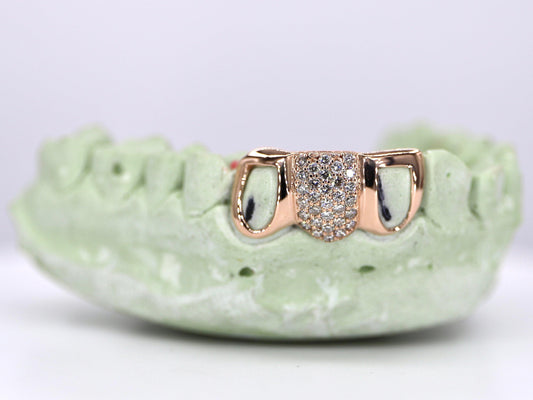 1 Tooth & 2 Teeth Open Faced VVS Moissanite Grillz