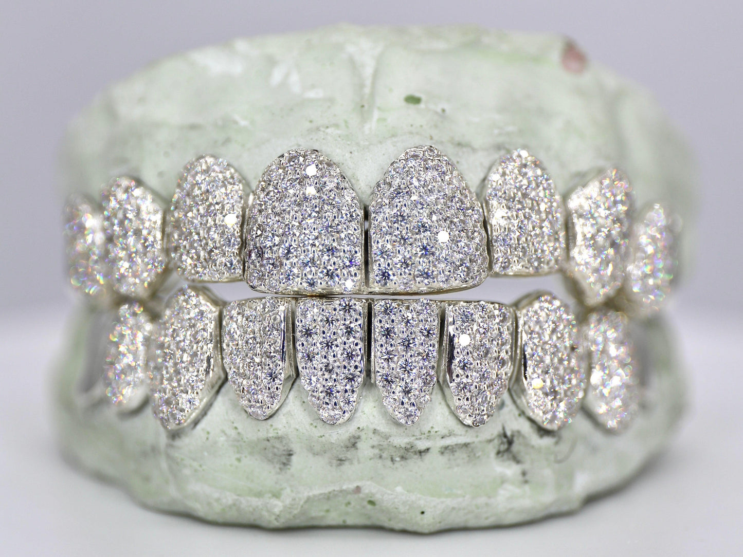 10 on 10 Capped VVS Moisannite Grillz