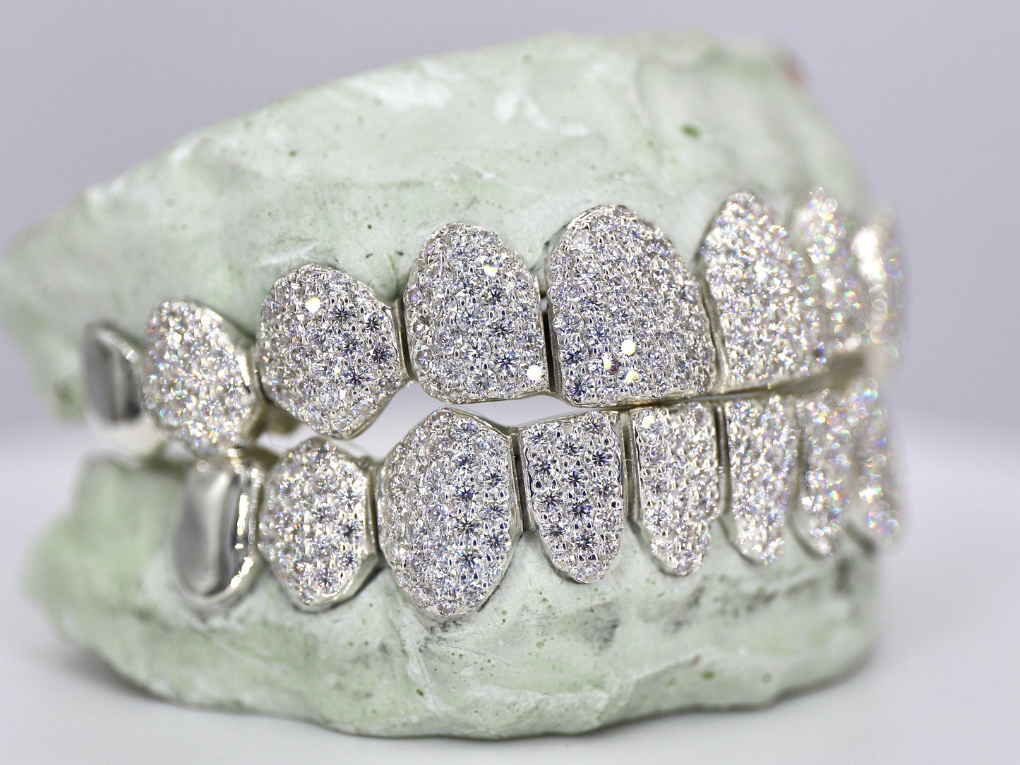 10 on 10 Capped VVS Moisannite Grillz