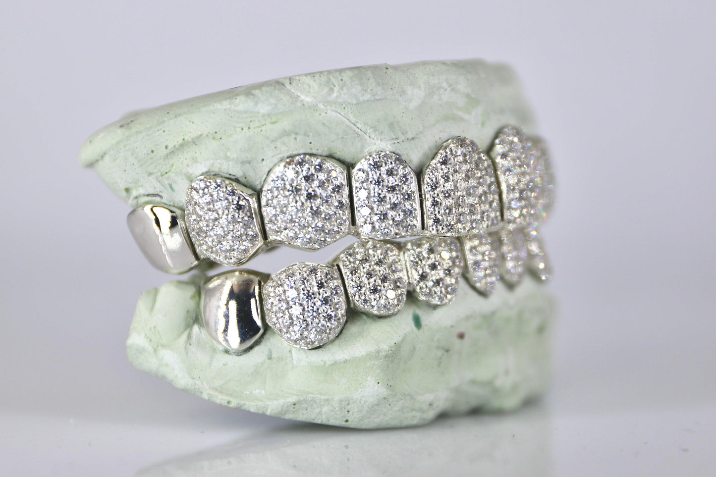 10 on 10 Capped VVS Moisannite Grillz