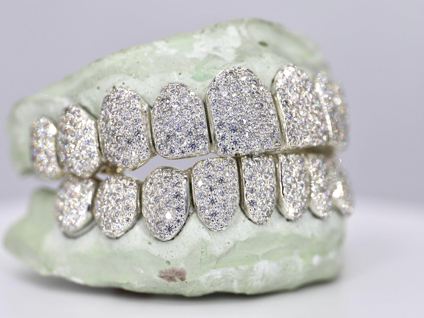 10 on 10 VVS Moisannite Grillz