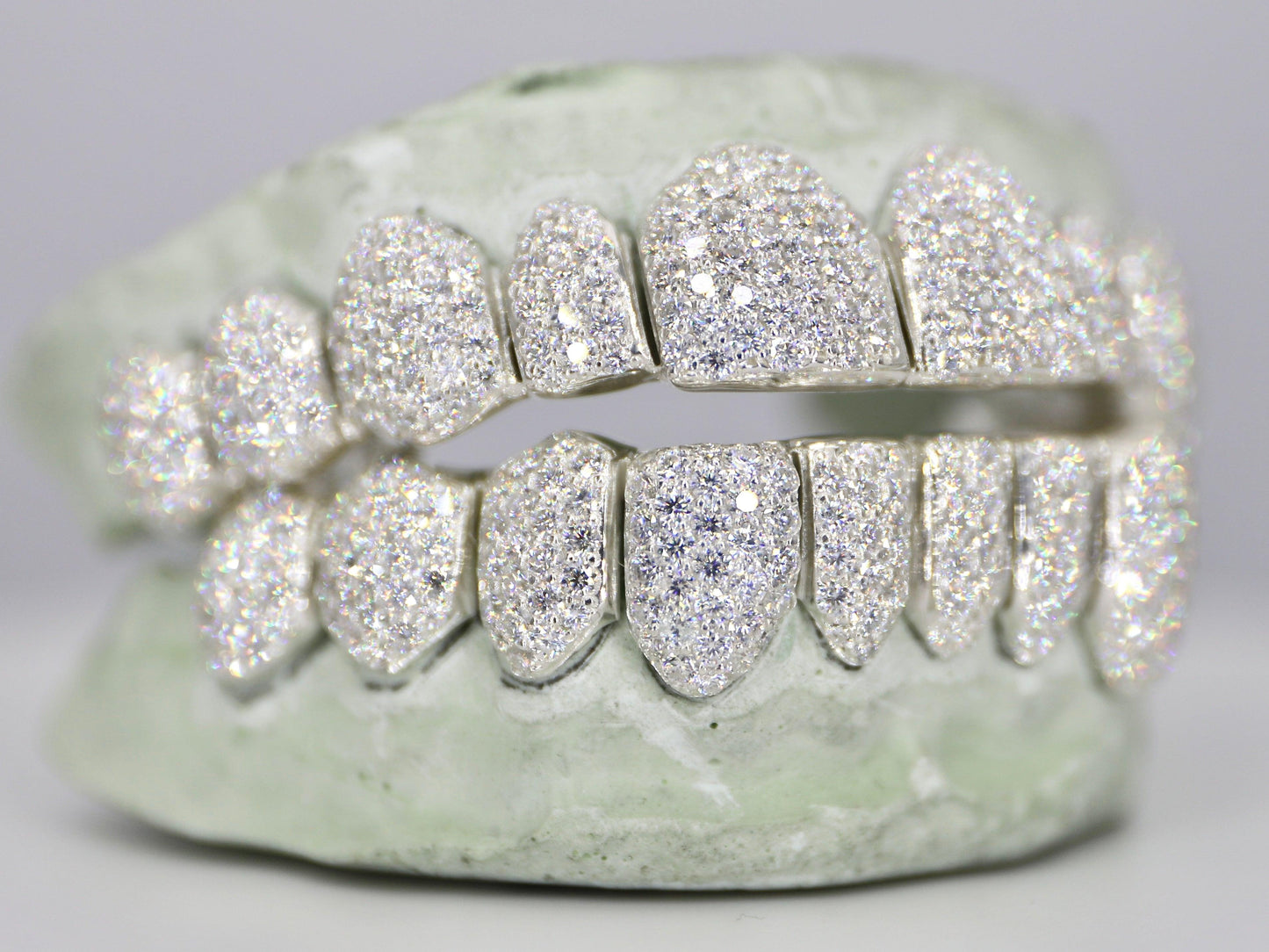 10 on 10 VVS Moisannite Grillz