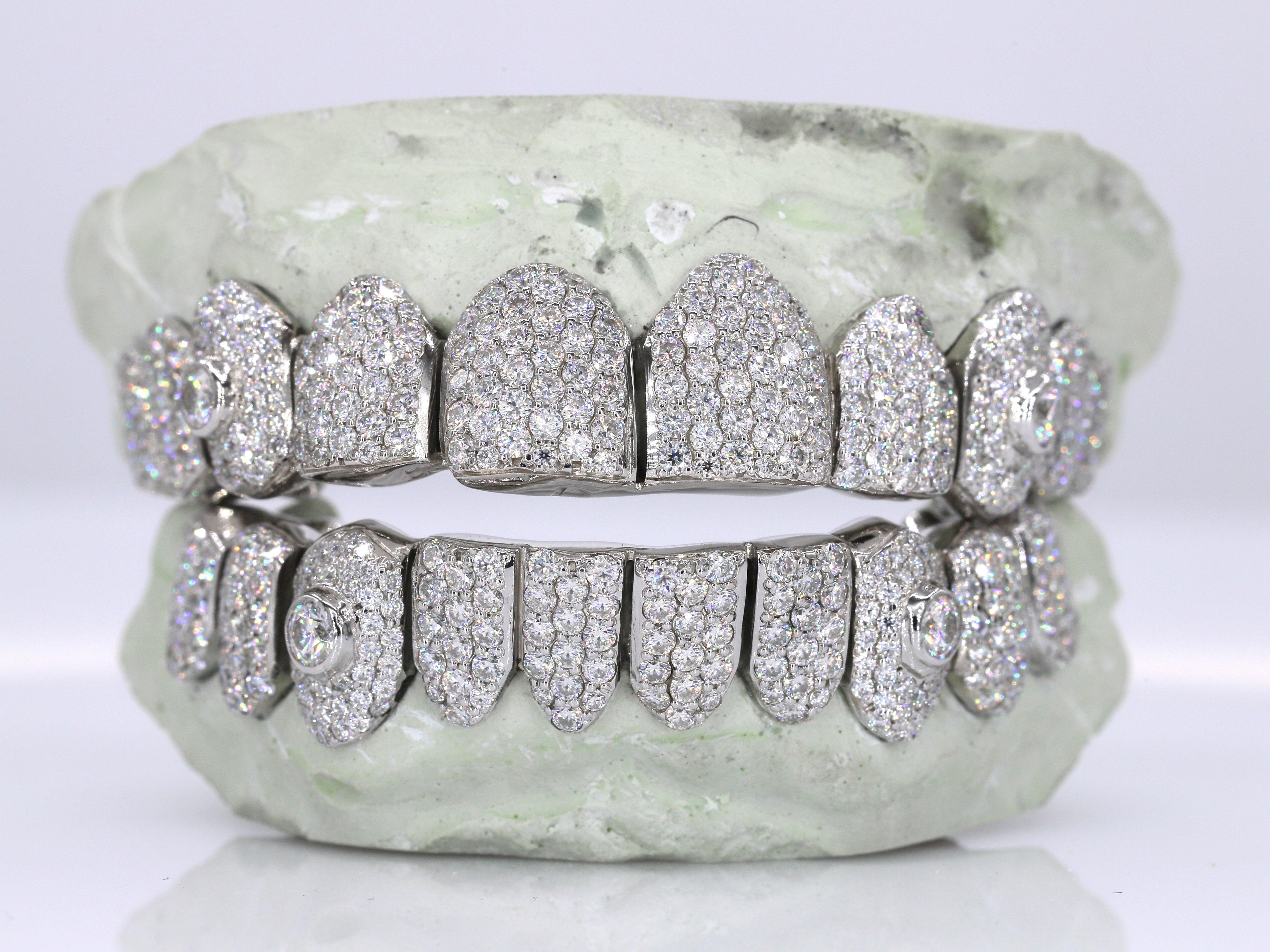 Big Stone VVS Moissanite Diamond Grillz