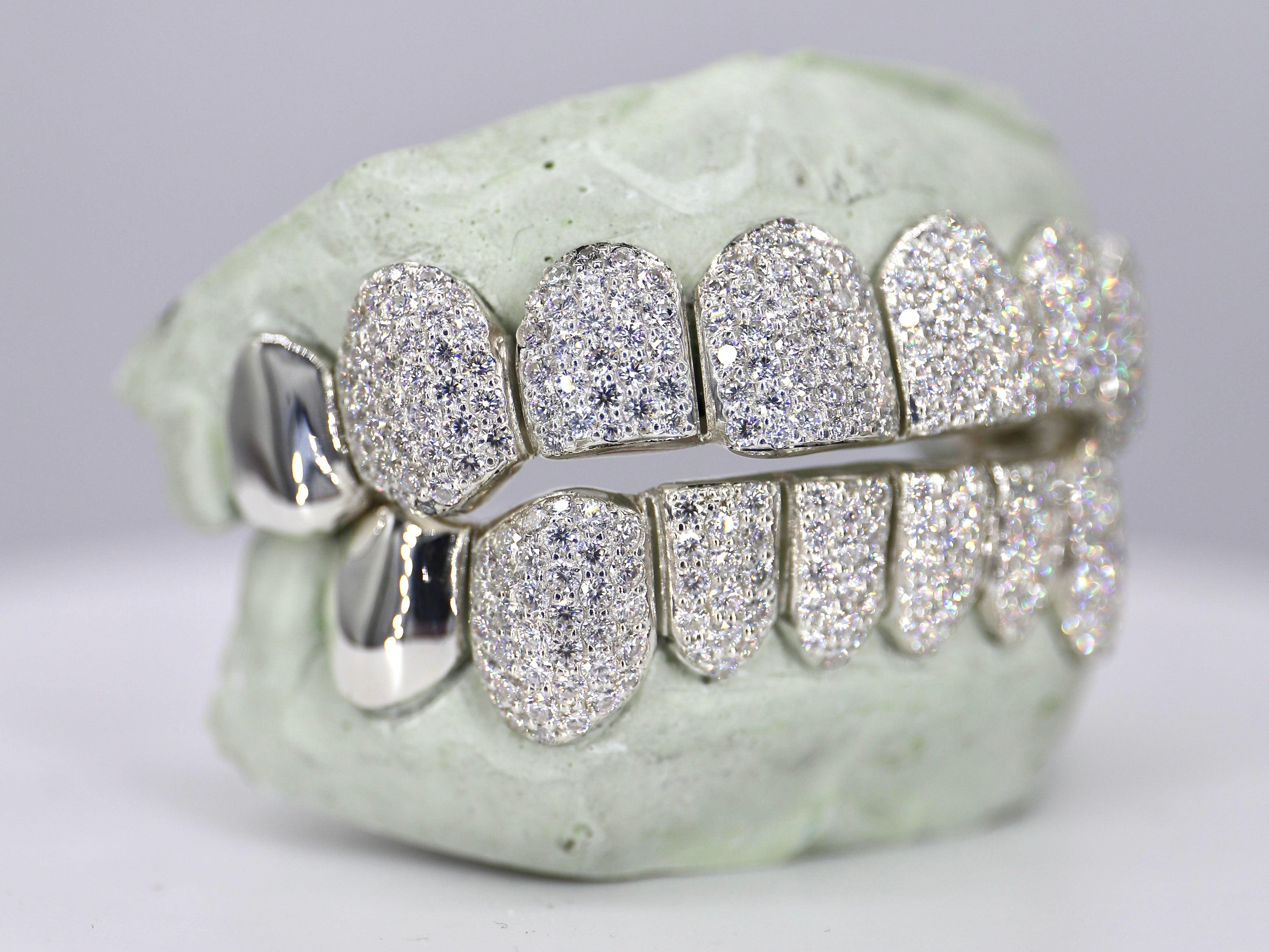 Real white sale gold diamond grillz