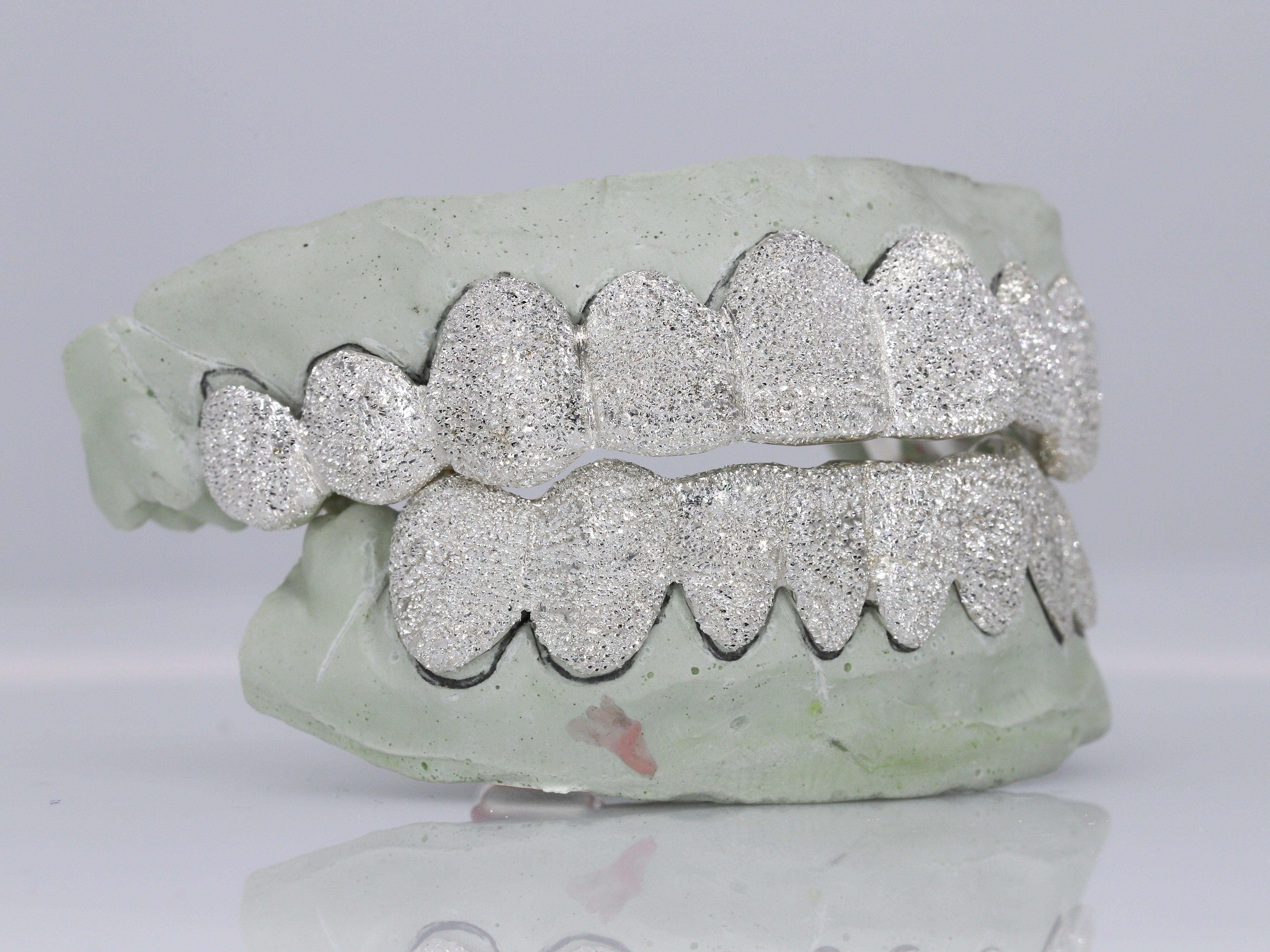 Diamond Dust Grillz