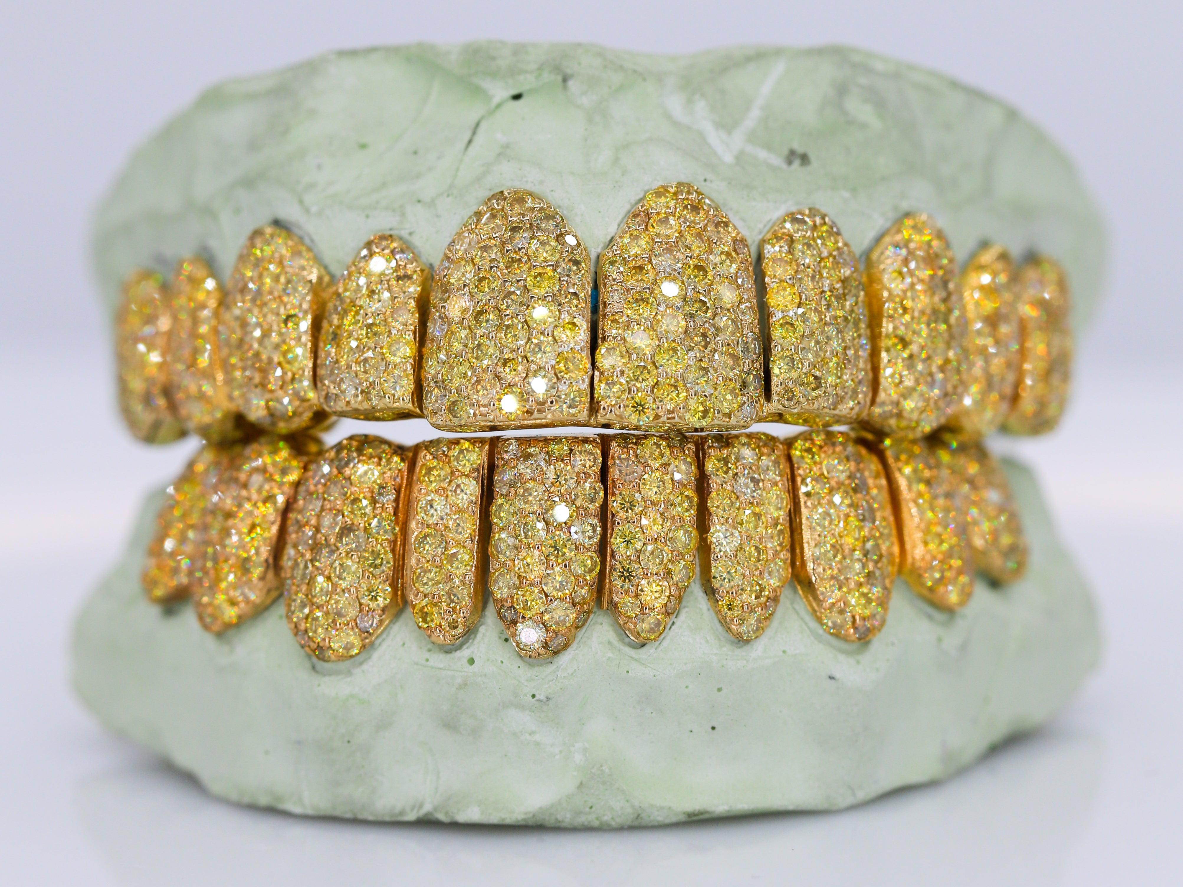 Canary Yellow VVS Moissanite Diamond Grillz