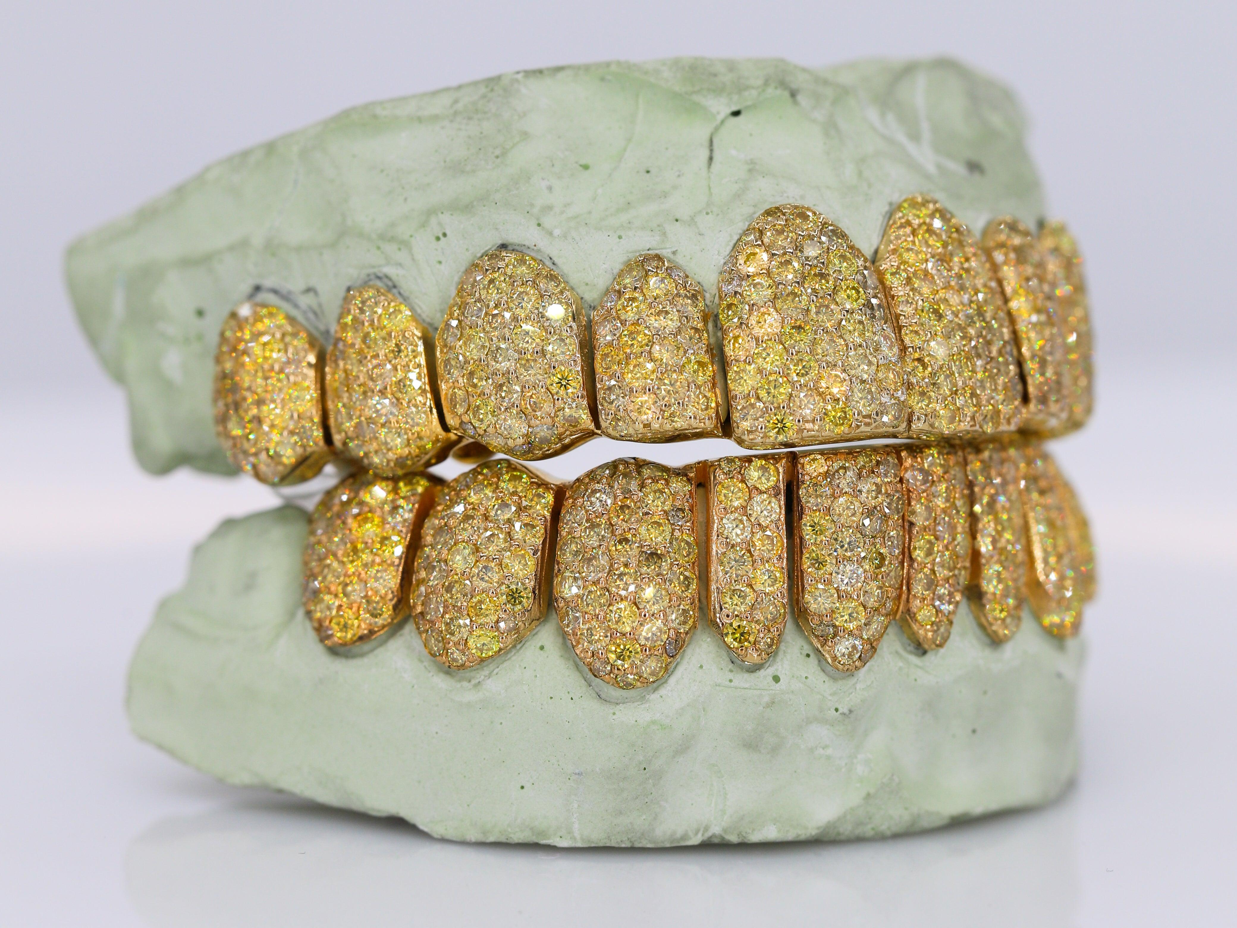 Canary Yellow VVS Moissanite Diamond Grillz