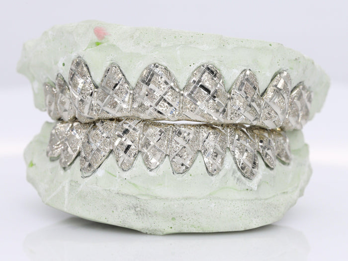 Diamond Dust Grillz – Moissanite Bazaar