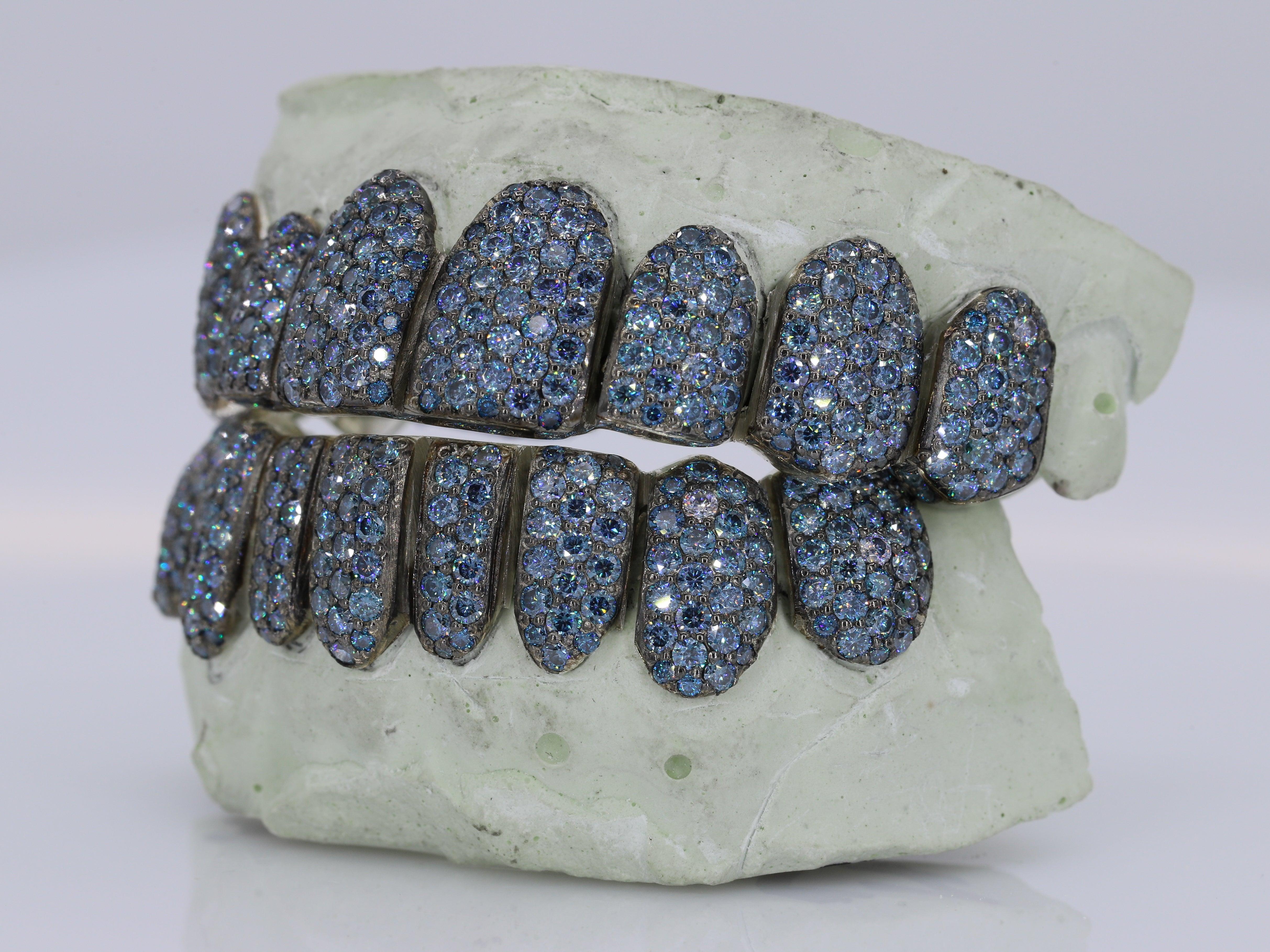 Ice Blue VVS Moissanite Diamond Grillz