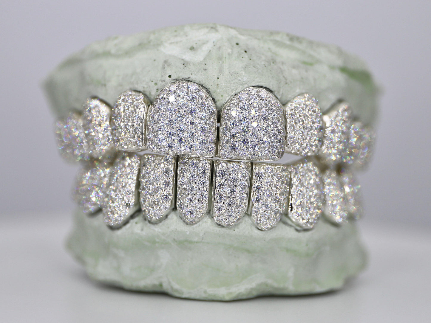 Custom VVS Moissanite Diamond Grillz