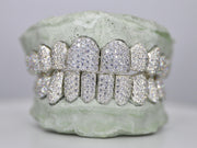 Custom VVS Moissanite Diamond Grillz