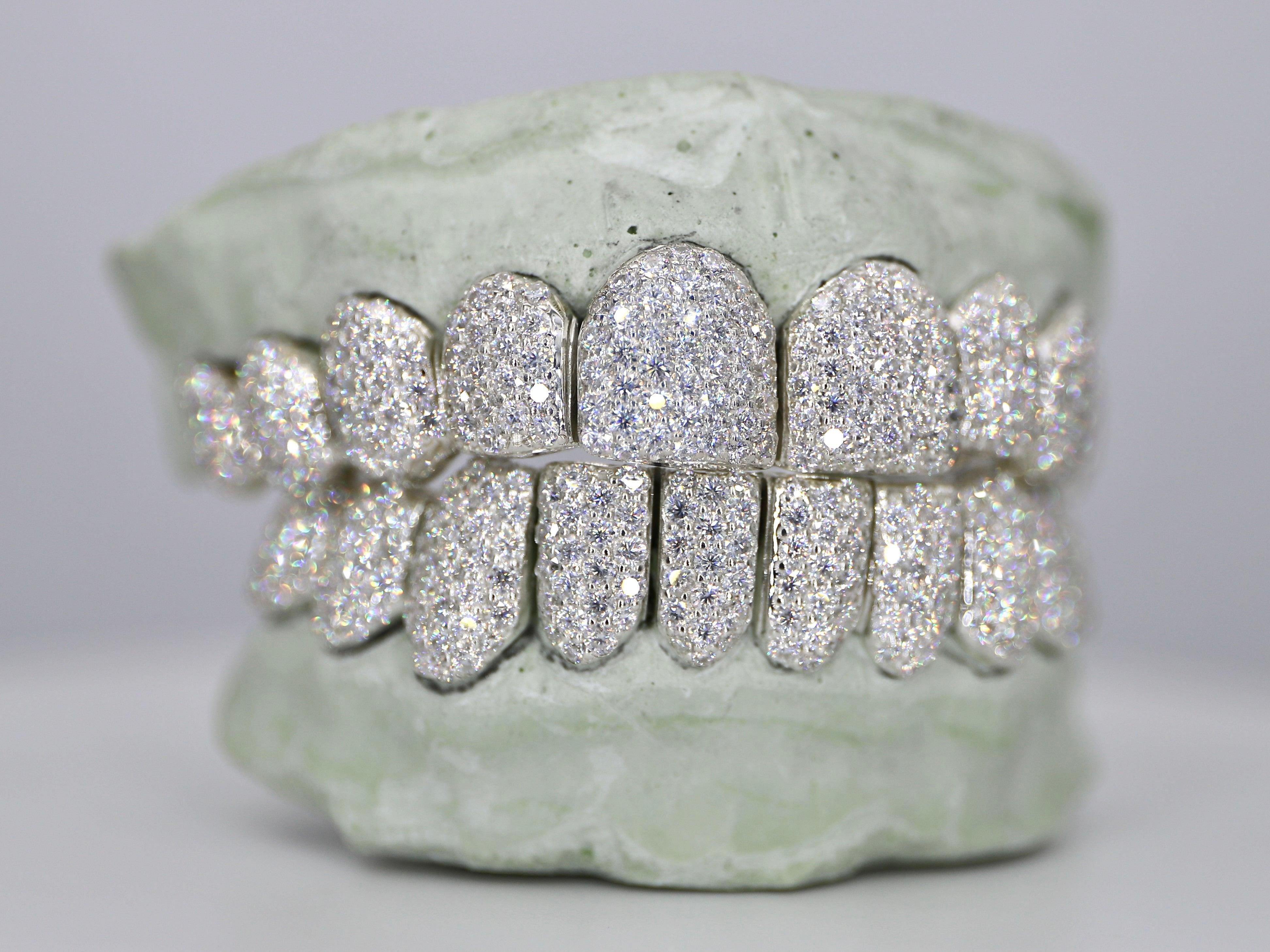 Custom VVS Moissanite Diamond Grillz