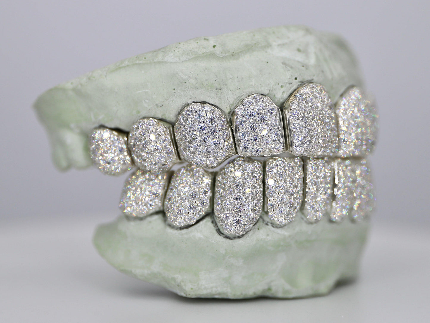 Custom VVS Moissanite Diamond Grillz