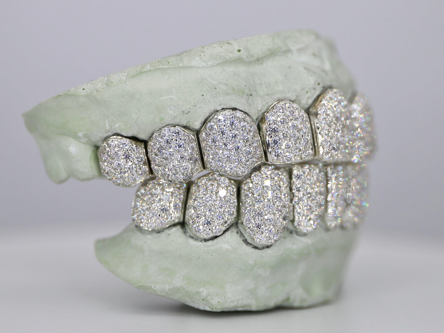 Custom VVS Moissanite Diamond Grillz