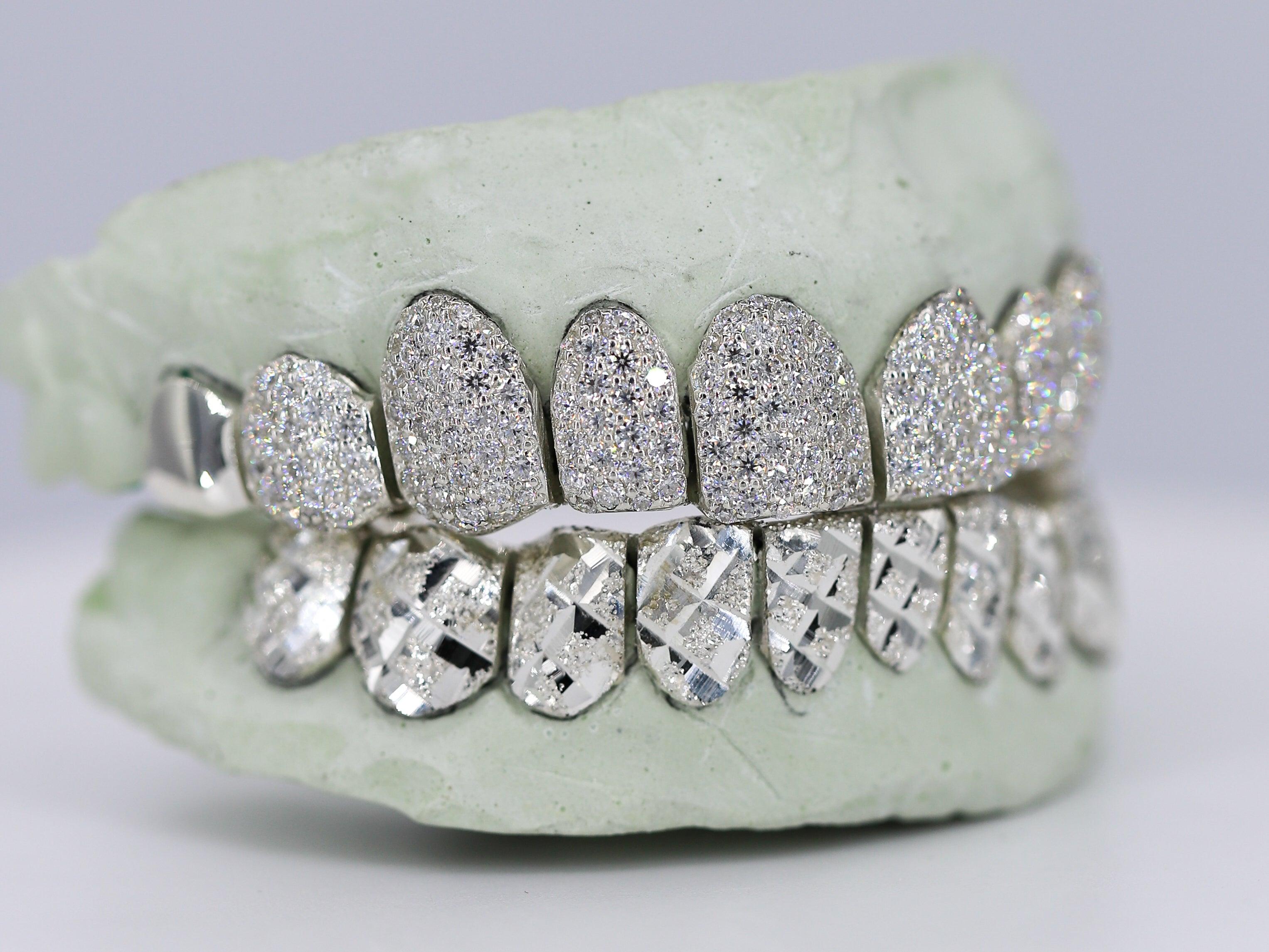 Diamond Top and Diamond Cut Bottom VVS Moisannite Diamond Grillz